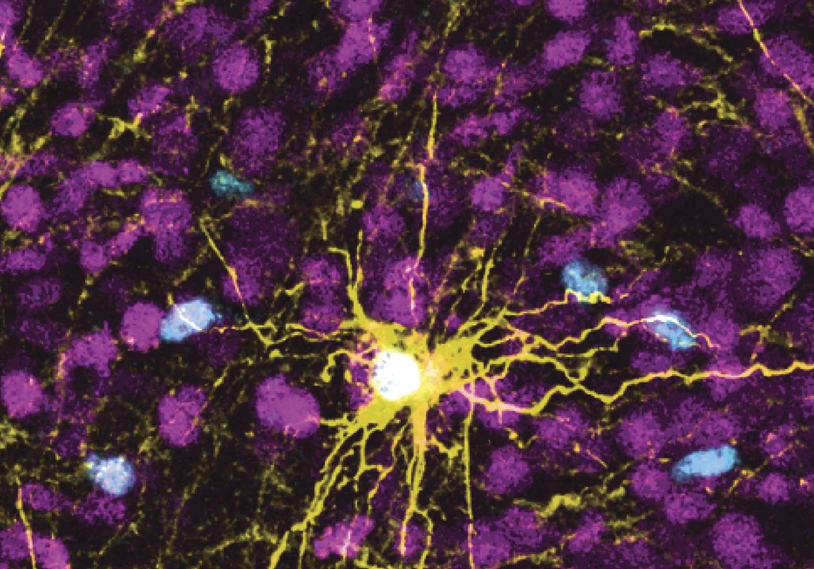 Scientists grow human brain cells in rats to study diseases