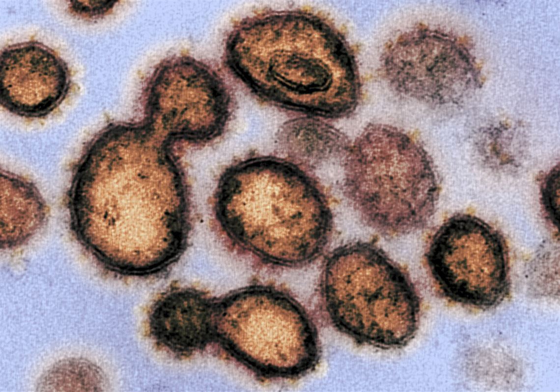 Western Pa Reports 4 New Deaths All In Allegheny County Pittsburgh Post Gazette