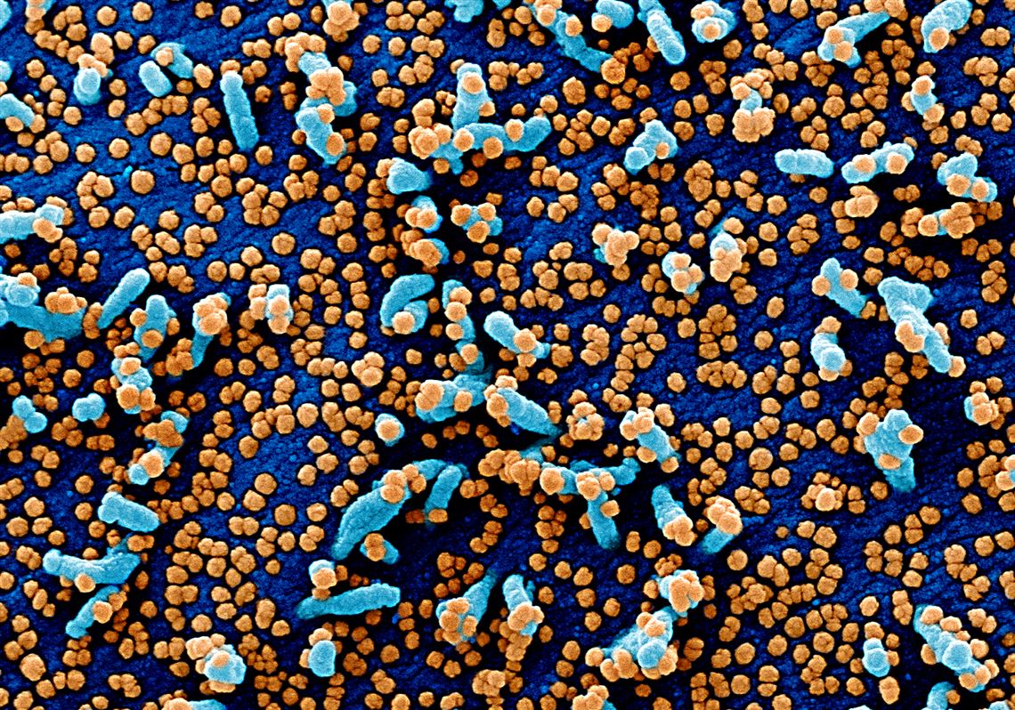Transmission electron micrograph of SARS-CoV-2 virus particles, isolated from a patient. Image captured and color-enhanced at the NIAID Integrated Research Facility (IRF) in Fort Detrick, Maryland.  Credit: National Institute of Allergy and Infectious Diseases, NIH