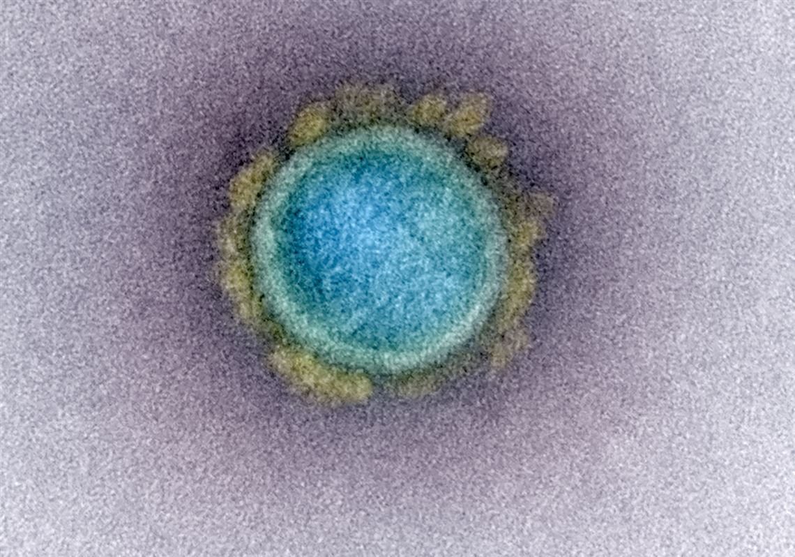 COVID19 Update Allegheny County cases fall, but new deaths rise by 6