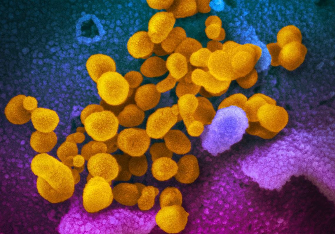 Allegheny County reports its 40th case of COVID19; nearly 500 cases in