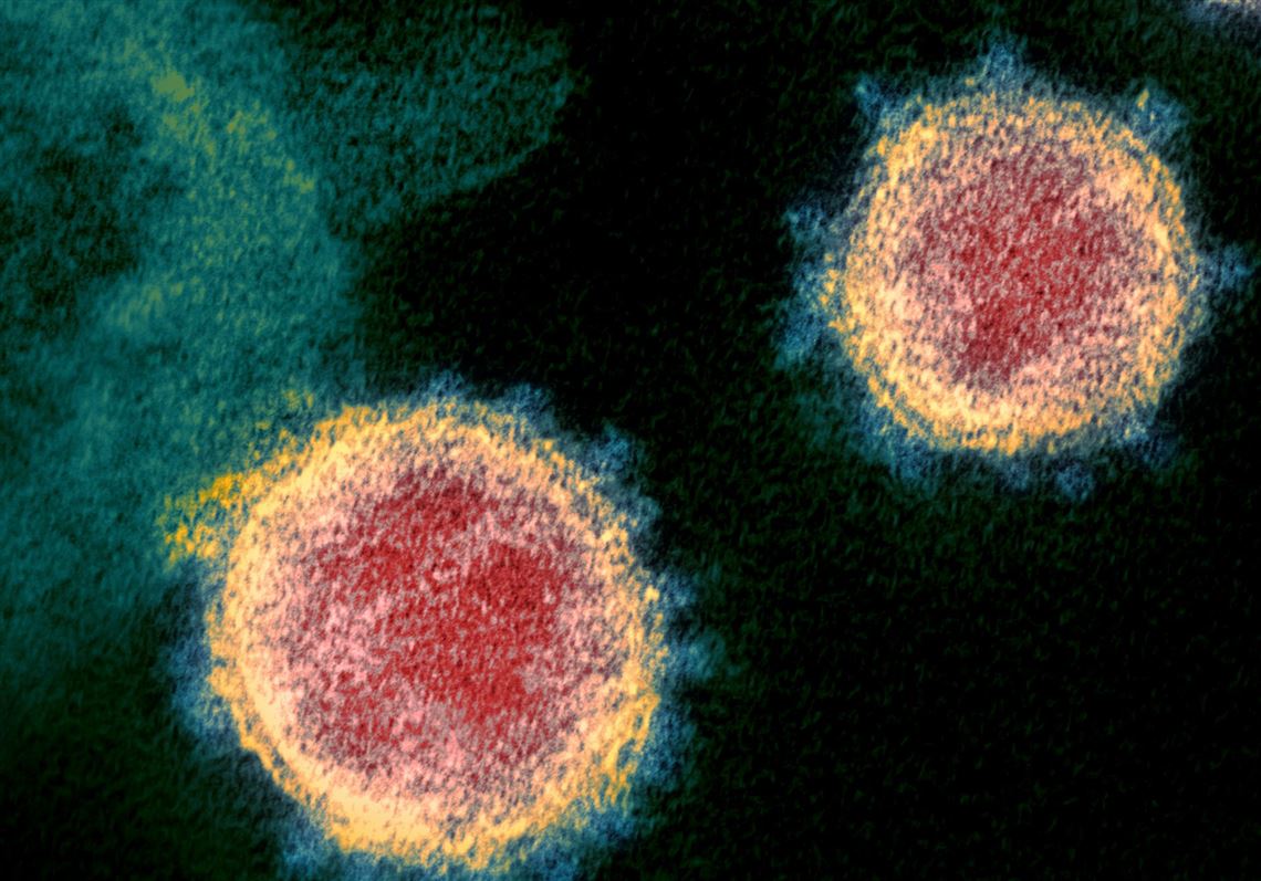 Allegheny County now has four cases of COVID19 Pittsburgh PostGazette