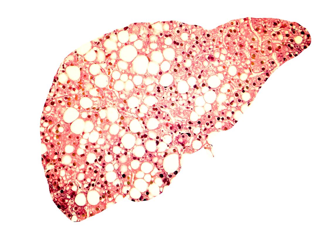 Helping The Liver Regenerate Itself Could Give Patien vrogue.co