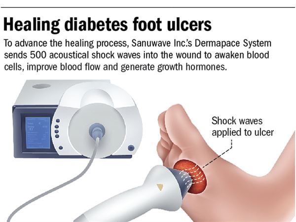 wound healing in diabetic patients