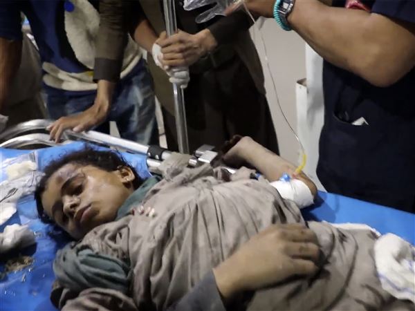 A wounded child being taken to a hospital in Yemen, on March 15, after American airstrikes over multiple targets in the country, in response to Houthi attacks on shipping in the Red Sea.